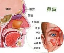 【全國愛鼻日】孩子出現(xiàn)這些癥狀，警惕鼻竇炎！