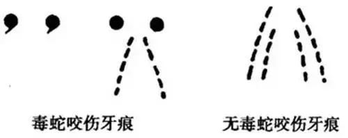 被蛇咬傷怎么辦？ 福德醫(yī)院教你毒蛇咬傷急救指南